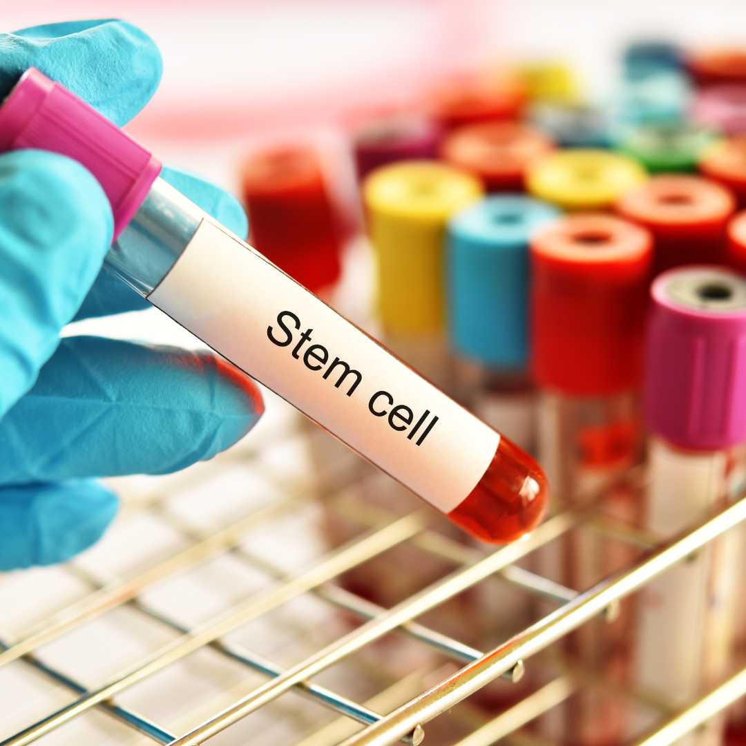 Stem Cell Therapy Germany vs USA: Your Guide to Regenerative Treatments