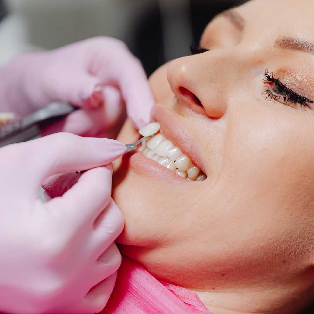 Dental Veneers: Turkey vs USA - Cost, Quality & Experience | PlacidWay