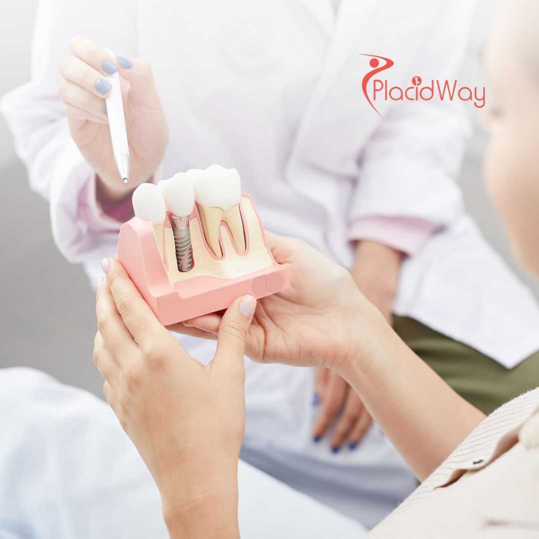 Dental Implants from Toronto to Los Algodones, Mexico – Save Big on Quality Dental Care