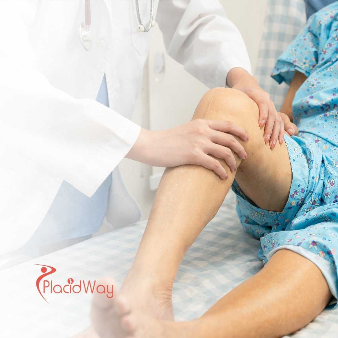 Knee Replacement Surgery from Toronto to Tijuana, Mexico – Trusted Surgeons for Canadians