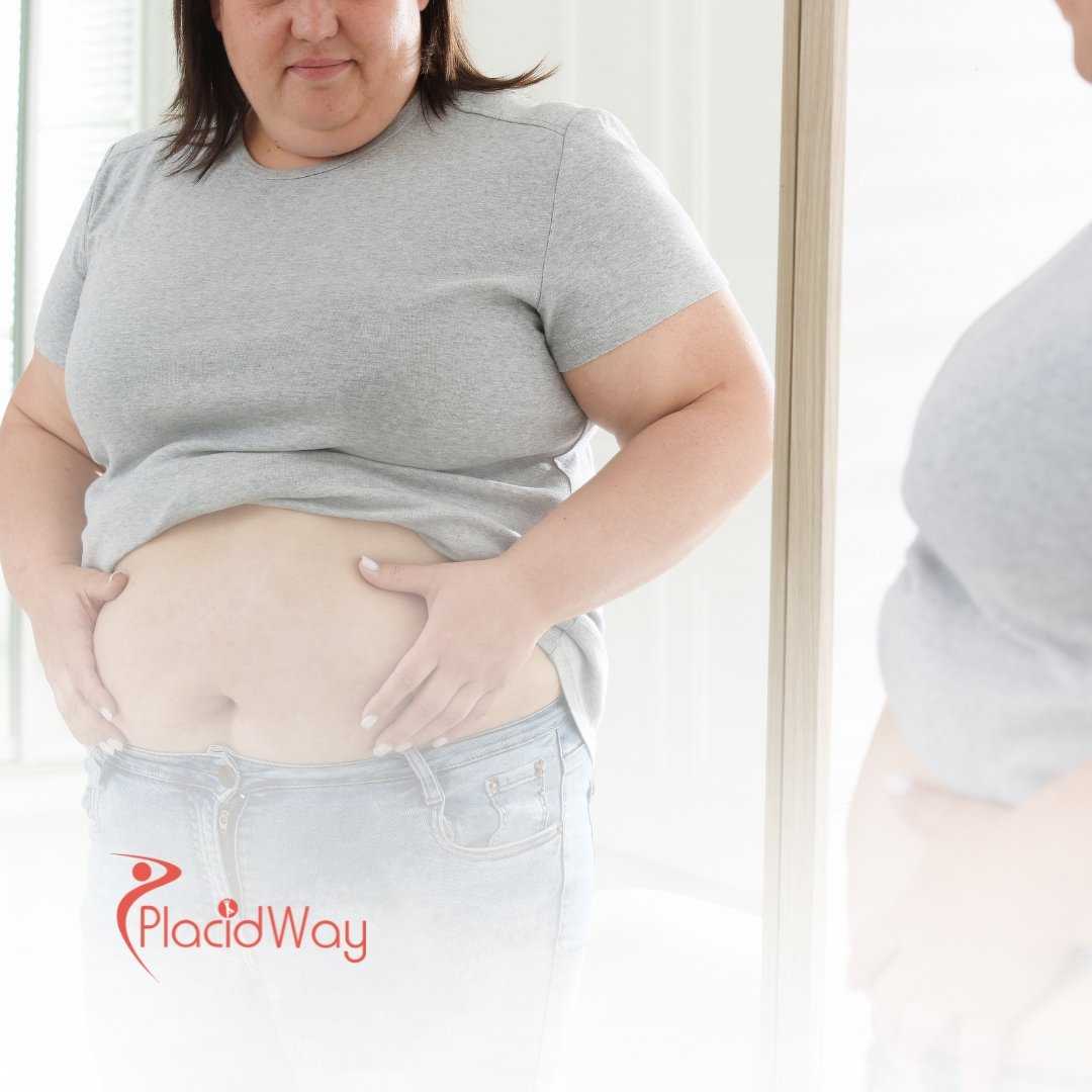 Bariatric Surgery in Cancún, Mexico: The Top Weight Loss Solution for Florida Residents