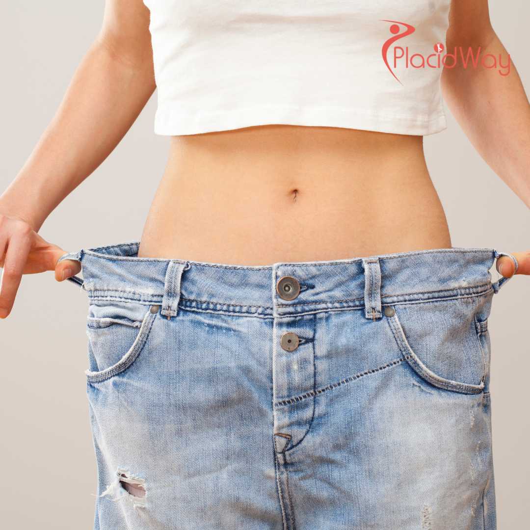 Bariatric Surgery in Cancún, Mexico: The Top Weight Loss Solution for Florida Residents