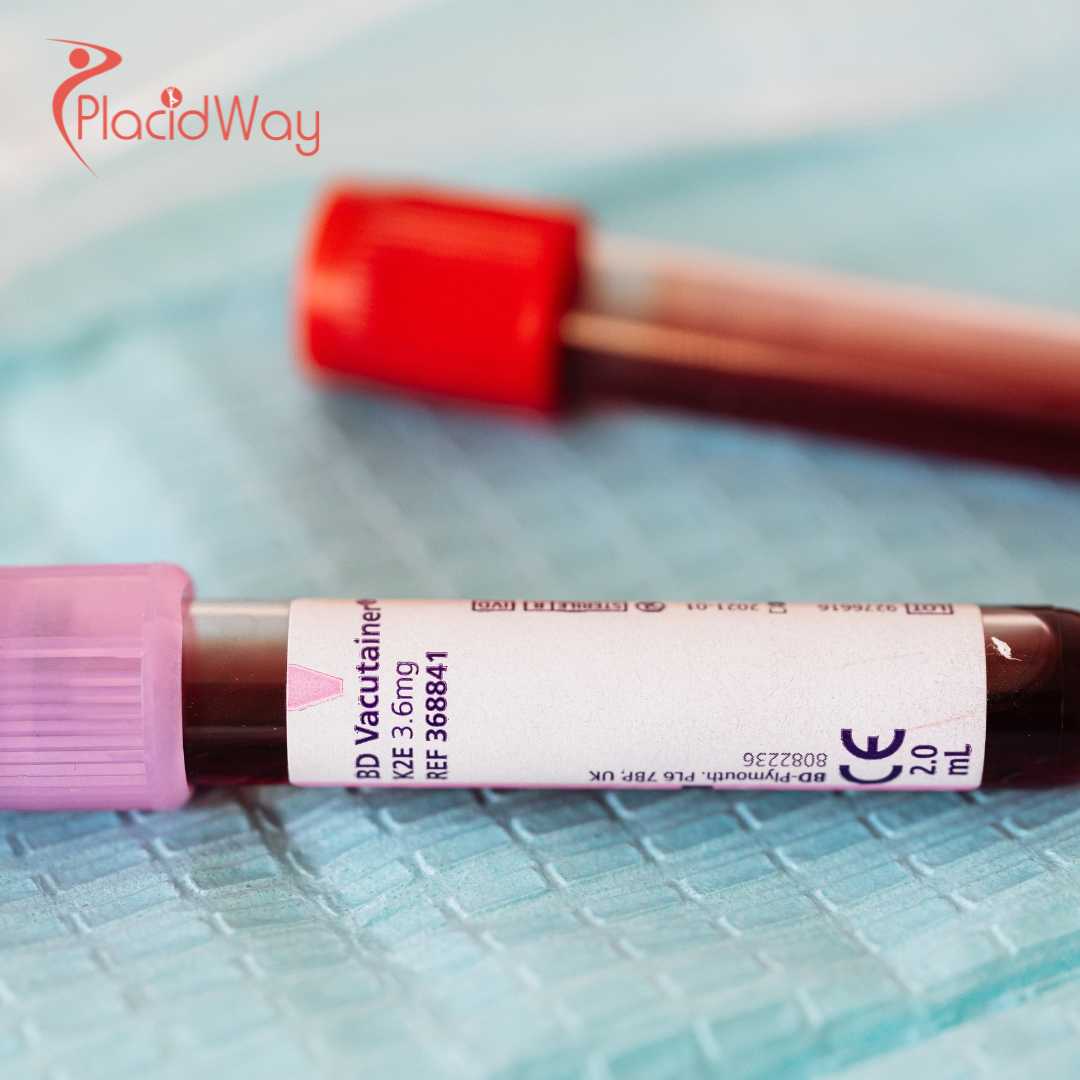 What to Expect from Stem Cell Treatments Abroad: Costs, Risks, and Recovery