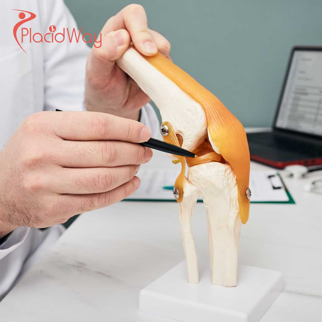 Stem Cell Therapy for Meniscus Injury in Japan: Things to Know