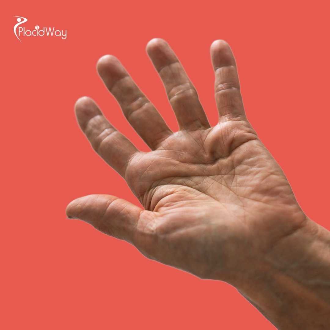 Guide for American Patients Seeking Tendon Injury Stem Cell Treatment in Mexico