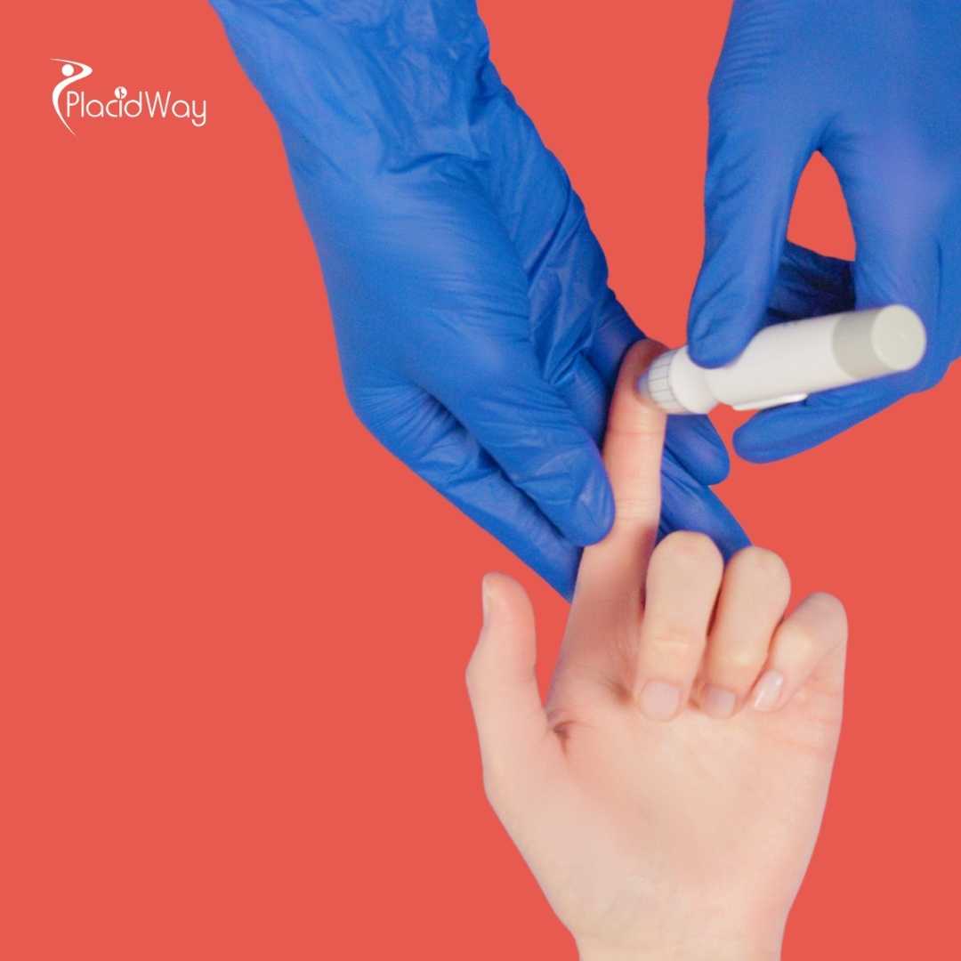 Stem Cell Therapy for Diabetes in Thailand: The Ultimate Guide for Myanmar Patients