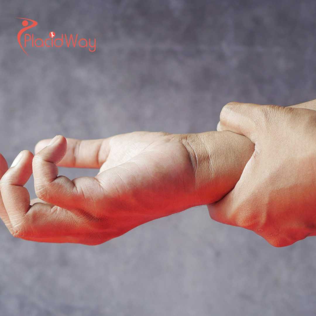 Stem Cell Therapy for Tendon Injury in Mexico: A Comprehensive Guide to Recovery and Costs