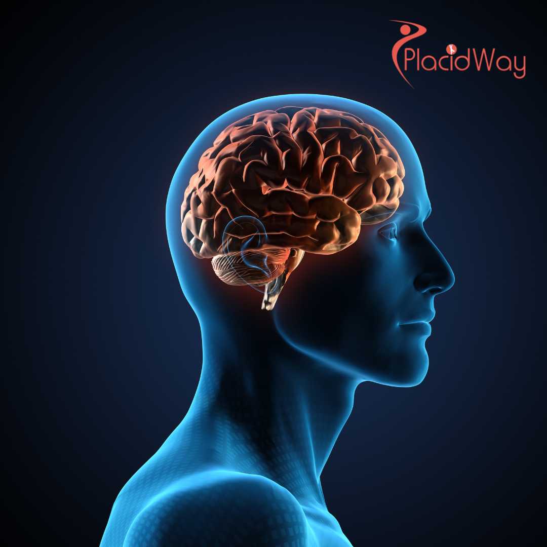 Brain Injury Stem Cell Therapy in Mexico: The Ultimate Guide for Medical Tourists