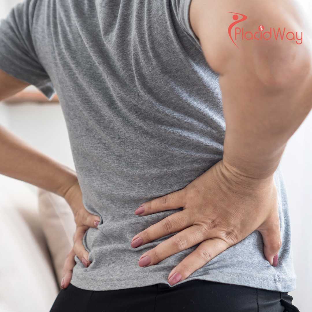 Stem Cell Therapy for Herniated Disc in Mexico: The Definitive Guide