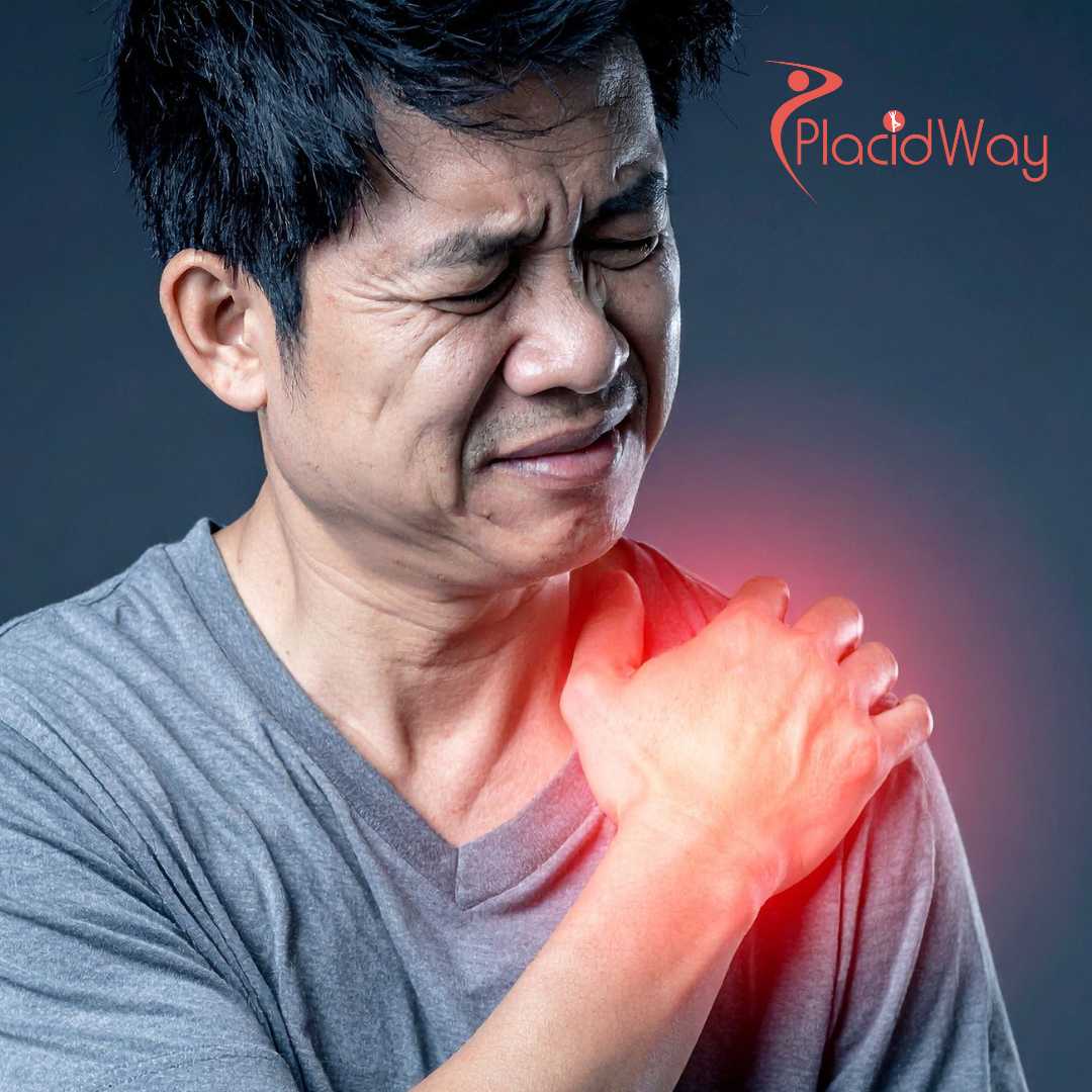 Shoulder Regeneration: A Medical Tourist’s Guide to Stem Cell Therapy in Thailand