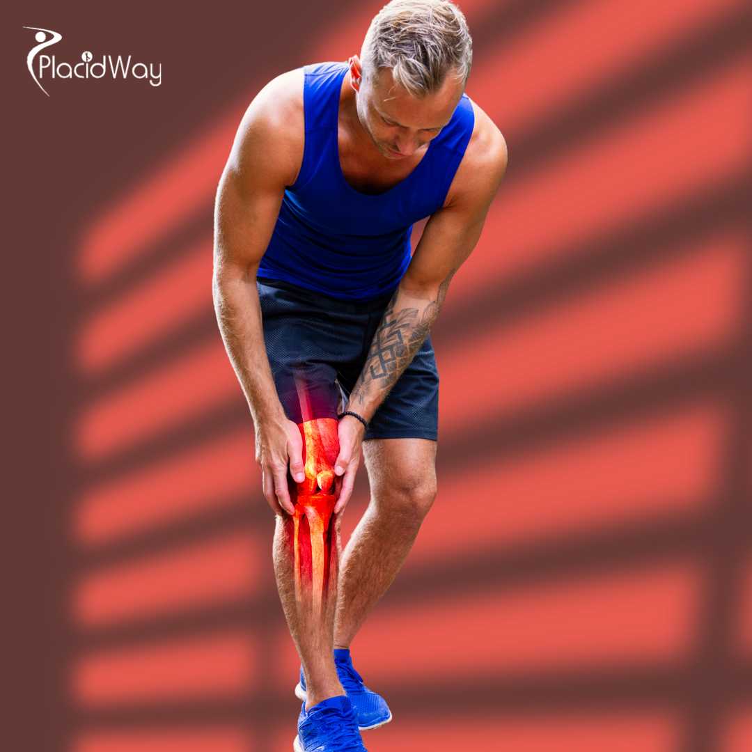 Osteoarthritis Stem Cell Therapy in Mexico for Patients from Central America Seeking Relief and Renewal