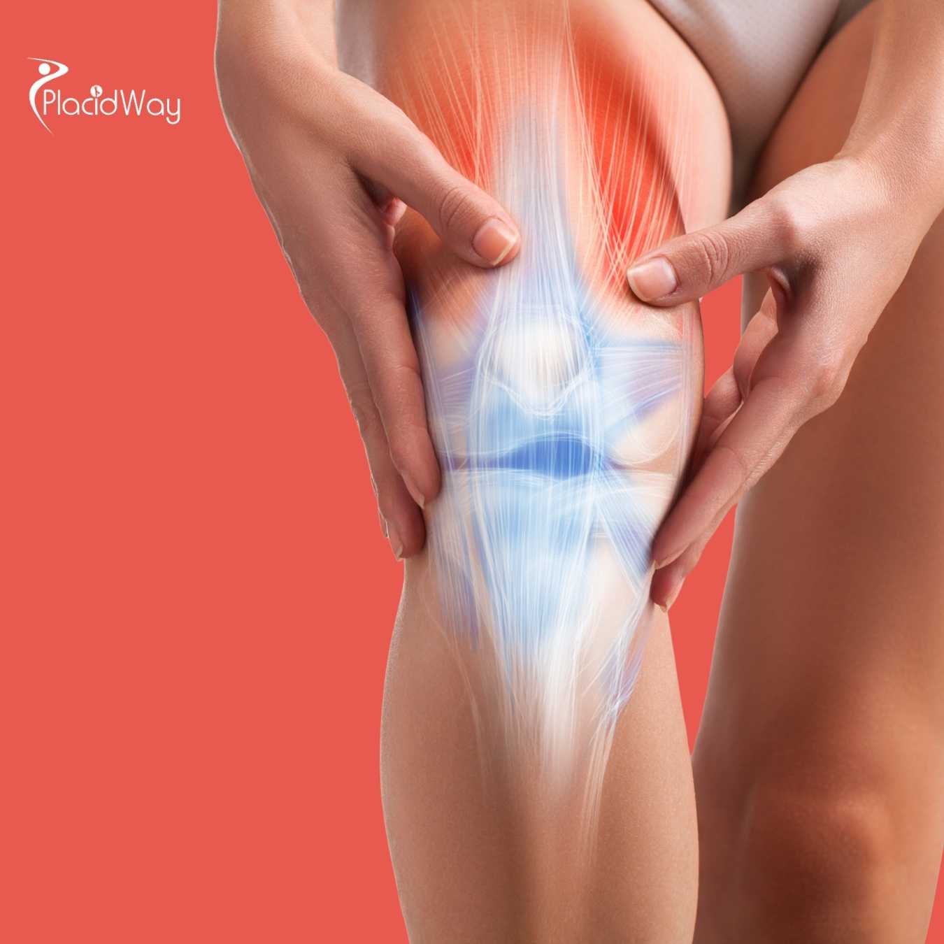 Osteoarthritis Stem Cell Therapy in Thailand: Key Information for Bangladeshi Patients