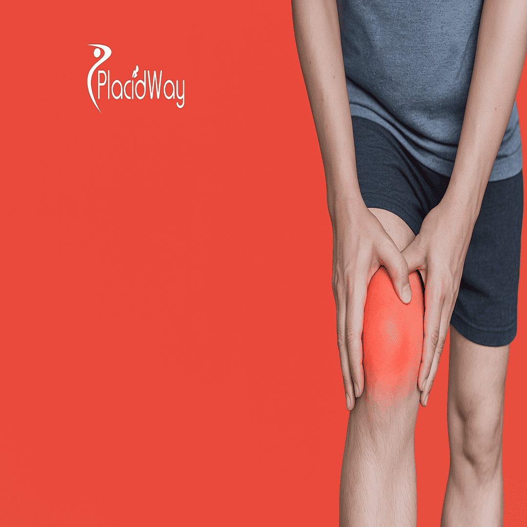 Stem Cell Therapy for Arthritis in Thailand for US Patients 