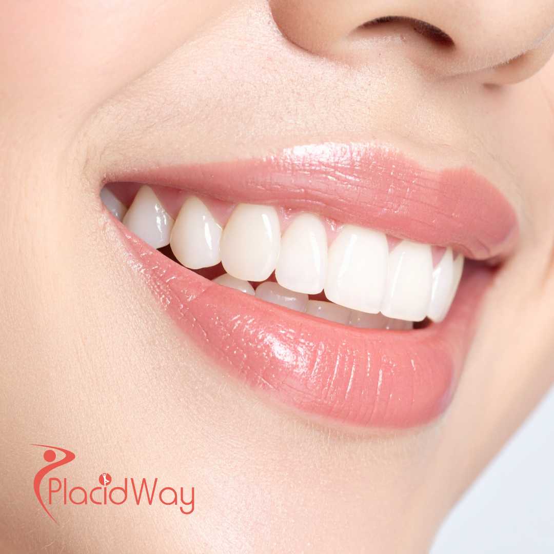 Cosmetic Dentistry in Turkey for Toronto & Markham Patients