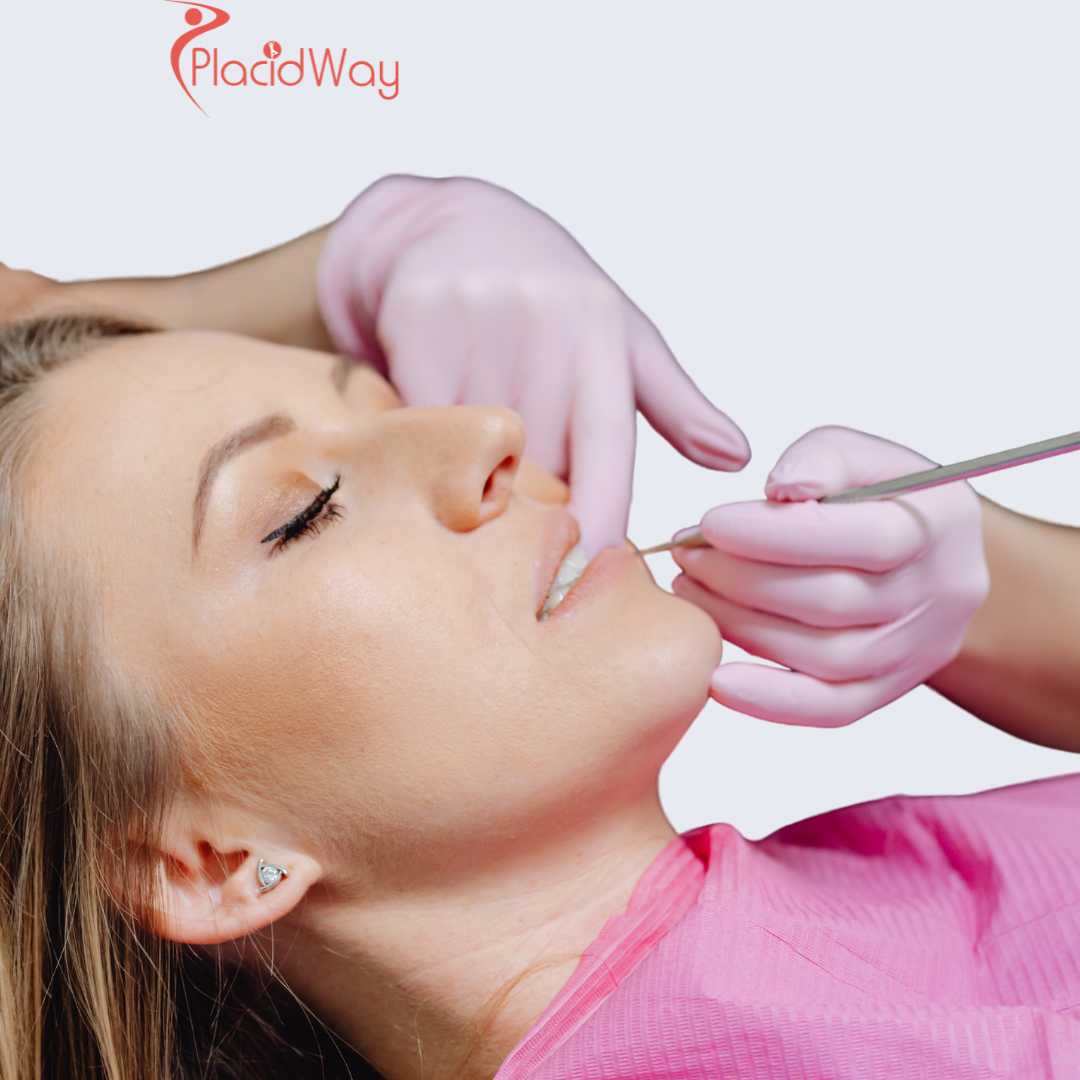 Dental Implants in Turkey for London Patients Facing High Private Dental Costs