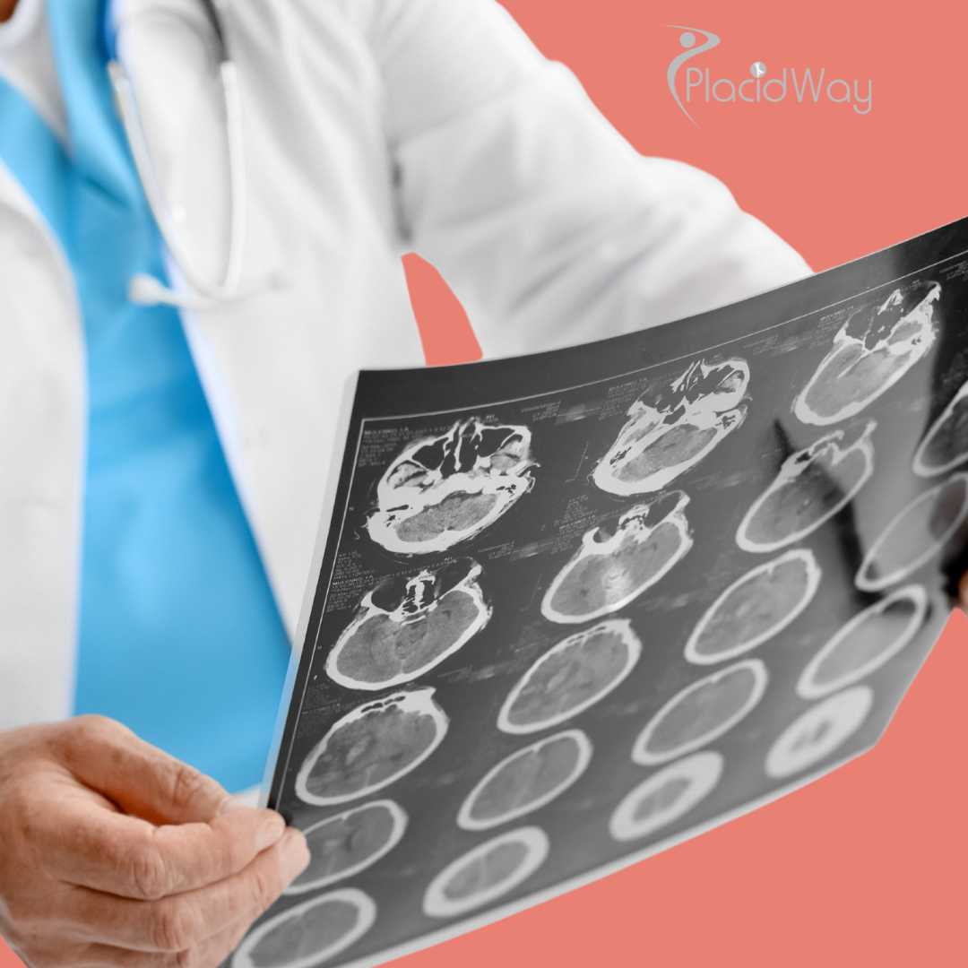 Ibogaine Treatment Considerations for Traumatic Brain Injury (TBI) Recovery in Mexico