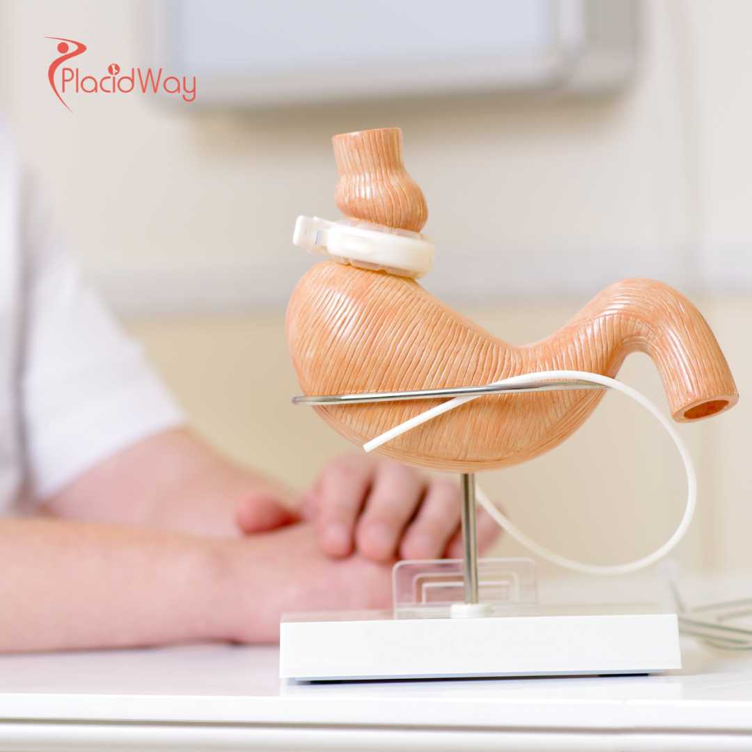 Revisional Bariatric Surgery in Turkey for Patients Restarting Their Weight Loss Journey