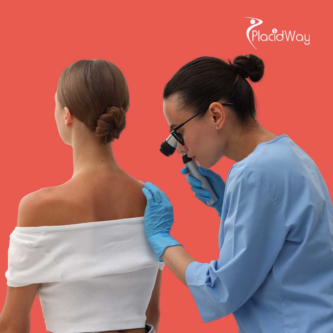 Melanoma Immunotherapy in Mexico: Trends, Patient FAQs, and Success Stories