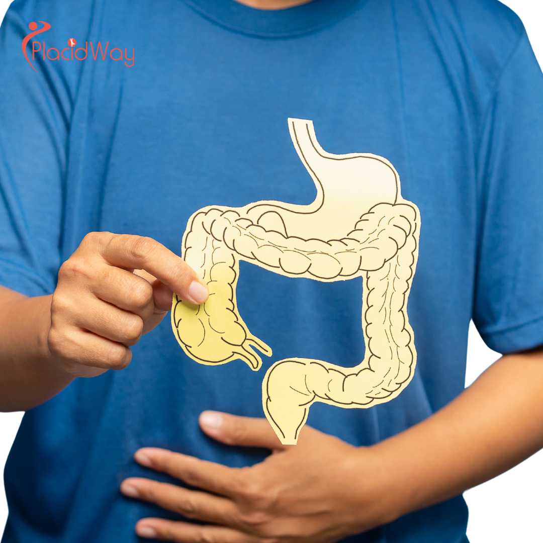 Alternative Colon Cancer Treatment in Tijuana - Can You Avoid Permanent Colostomy