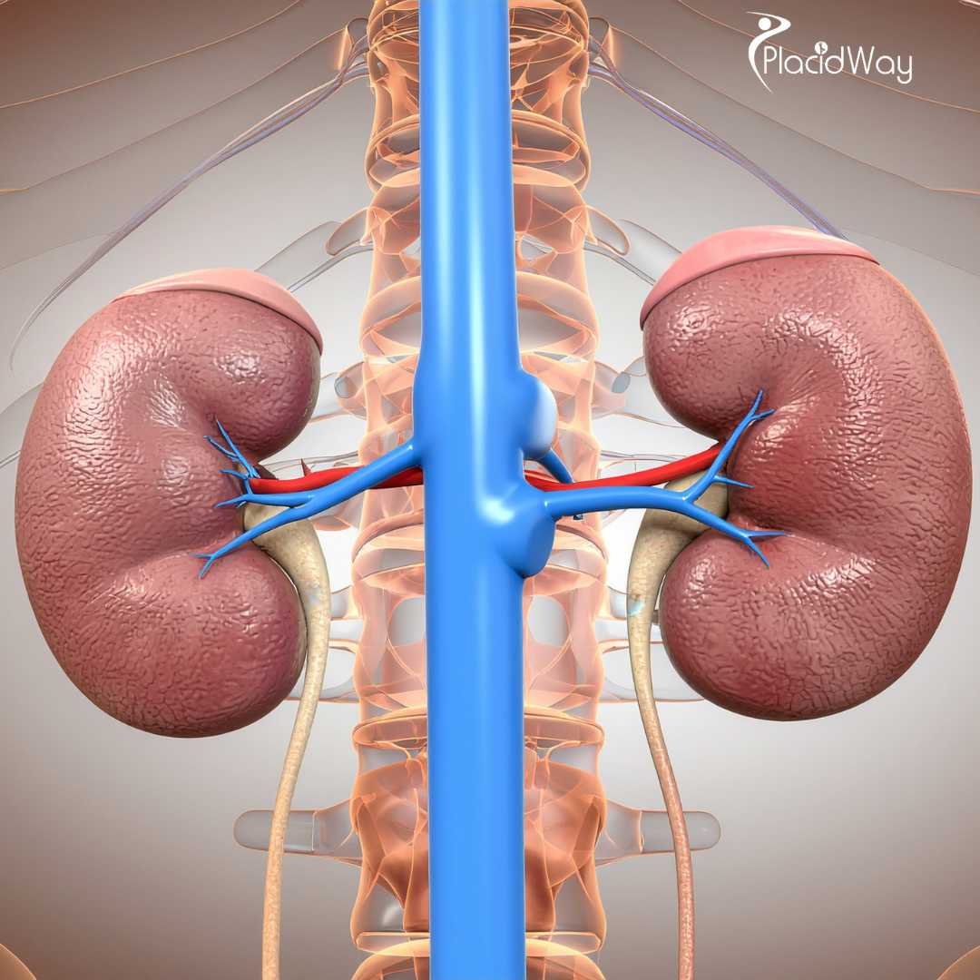 Integrative Kidney Cancer Treatment in Tijuana - Preserving Renal Function