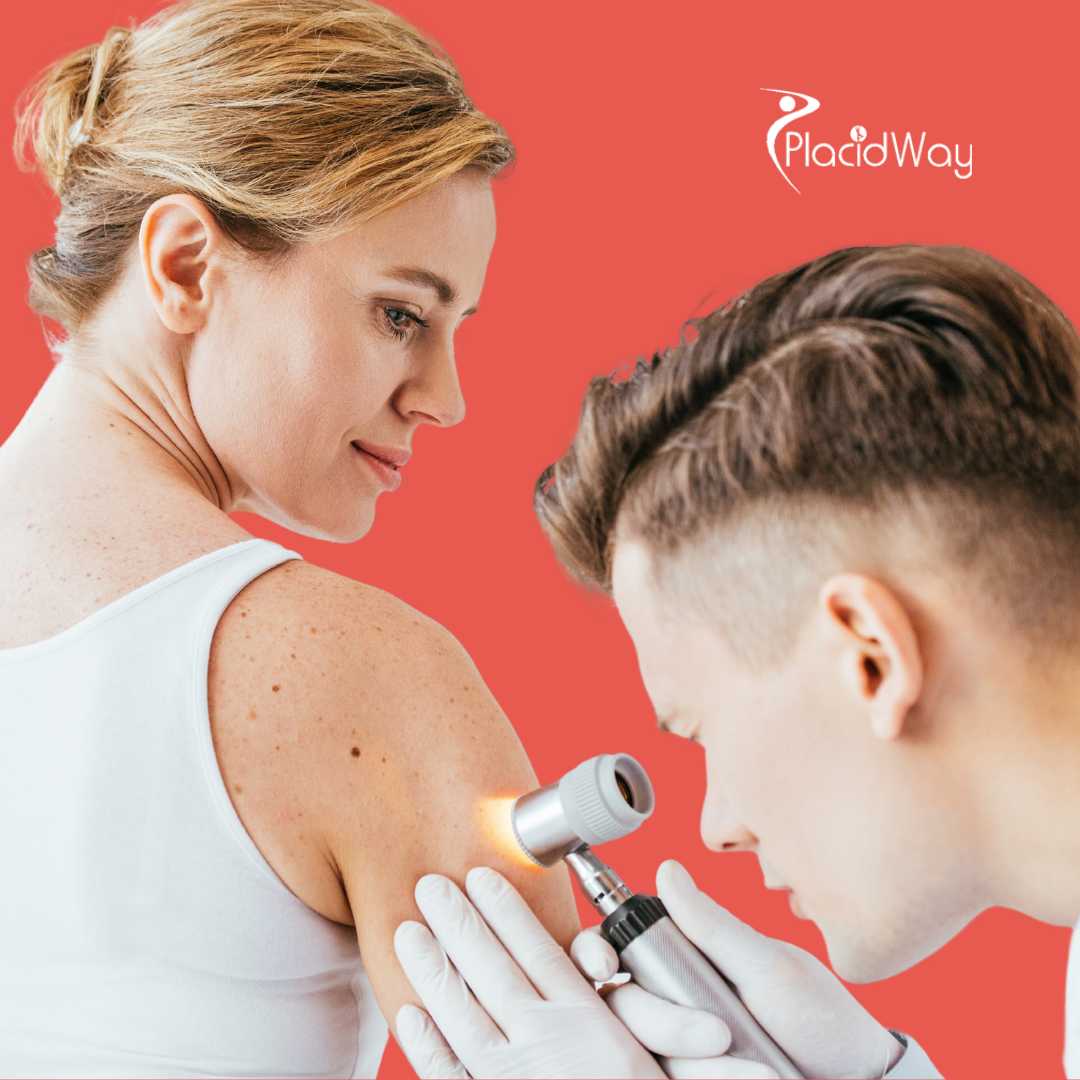 What Immunotherapy Options Exist for Melanoma in Mexico?