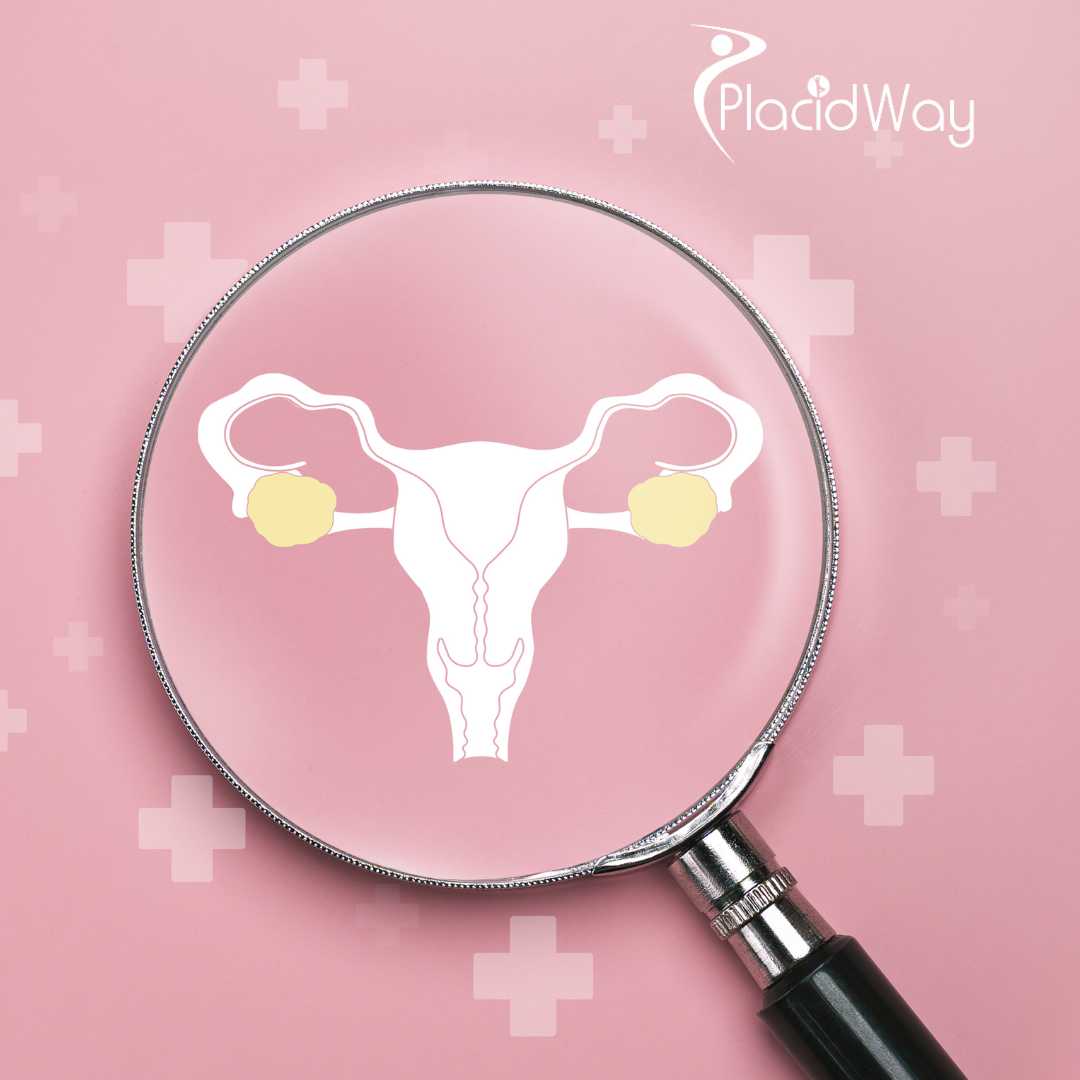 Advanced Ovarian Cancer Treatment in Tijuana - New Hope for Cancer Patients