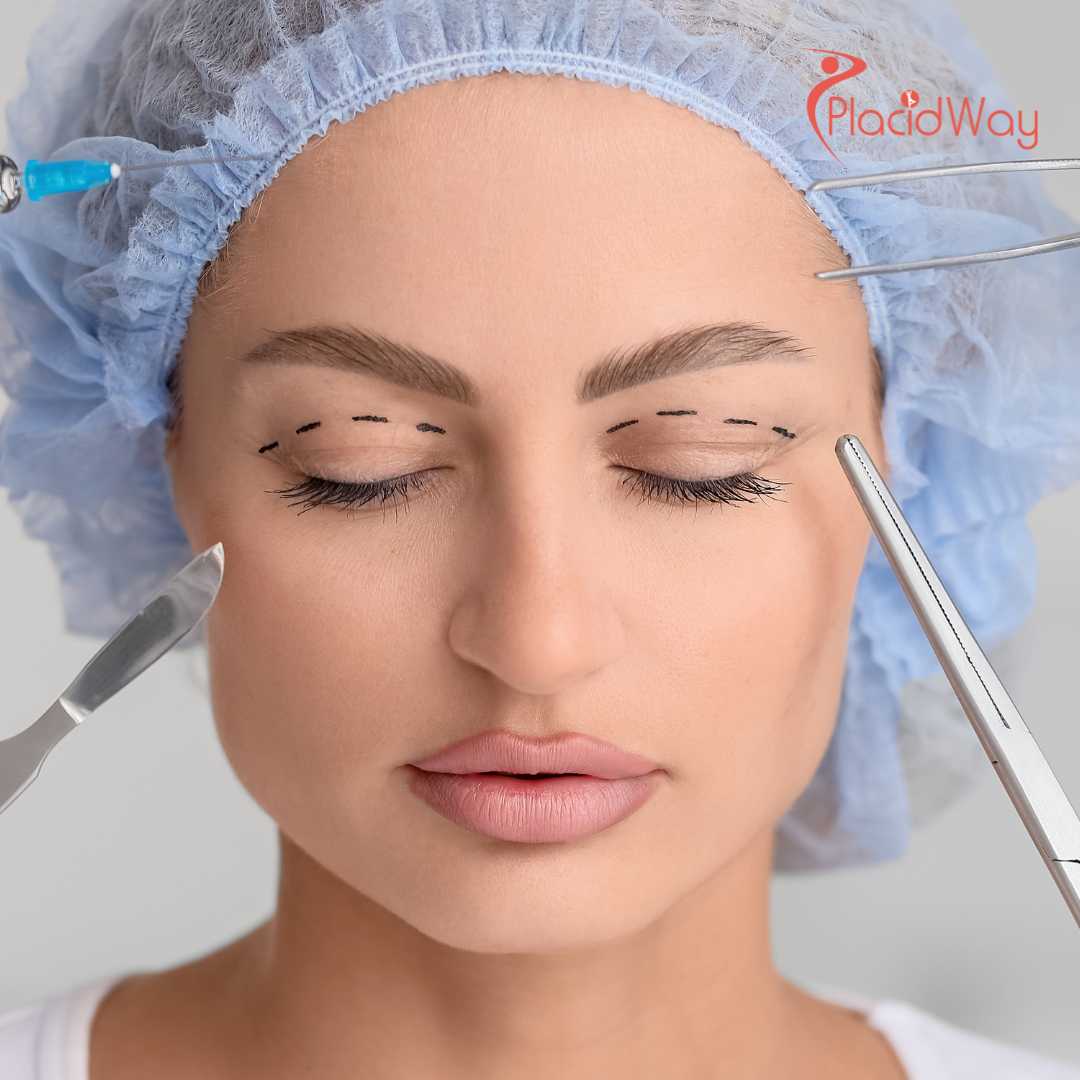 Thread Lift Treatments in Korean Clinics for Subtle, Non-Surgical Facial Tightening