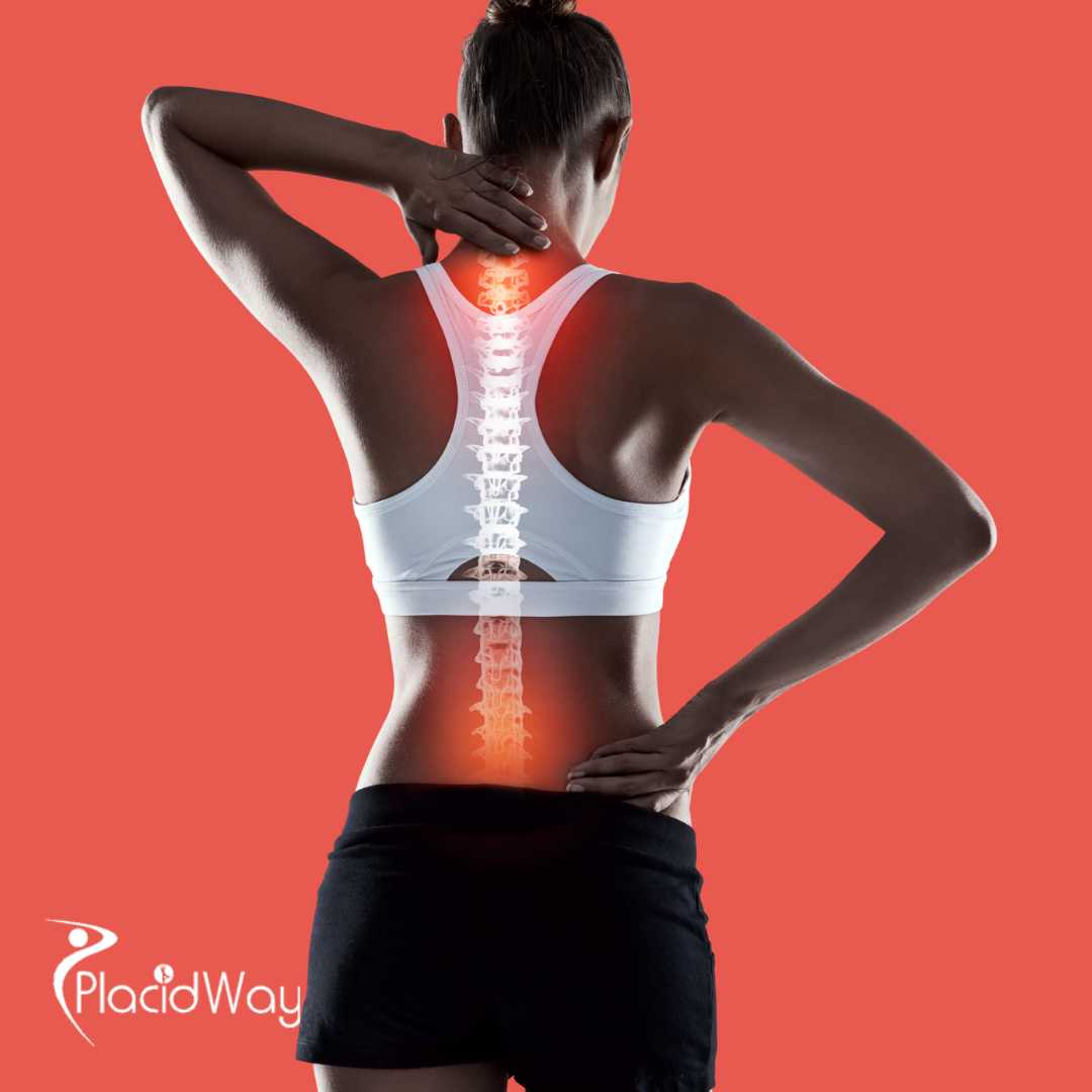  Advanced Spine Surgery in India for Patients Requiring Complex Spinal Care