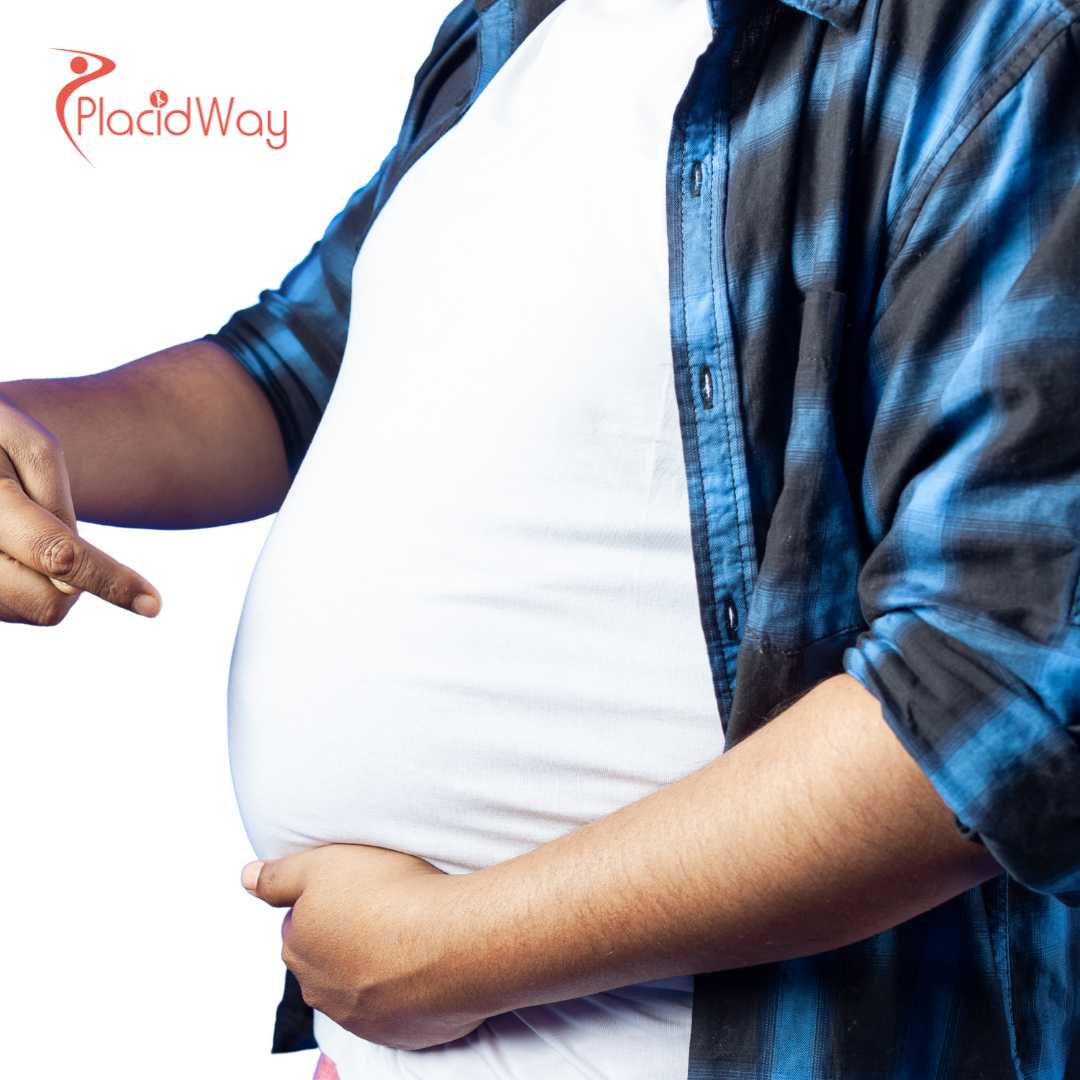 360° Liposuction in South Korea for Full-Body Contouring and Fat Reduction Results