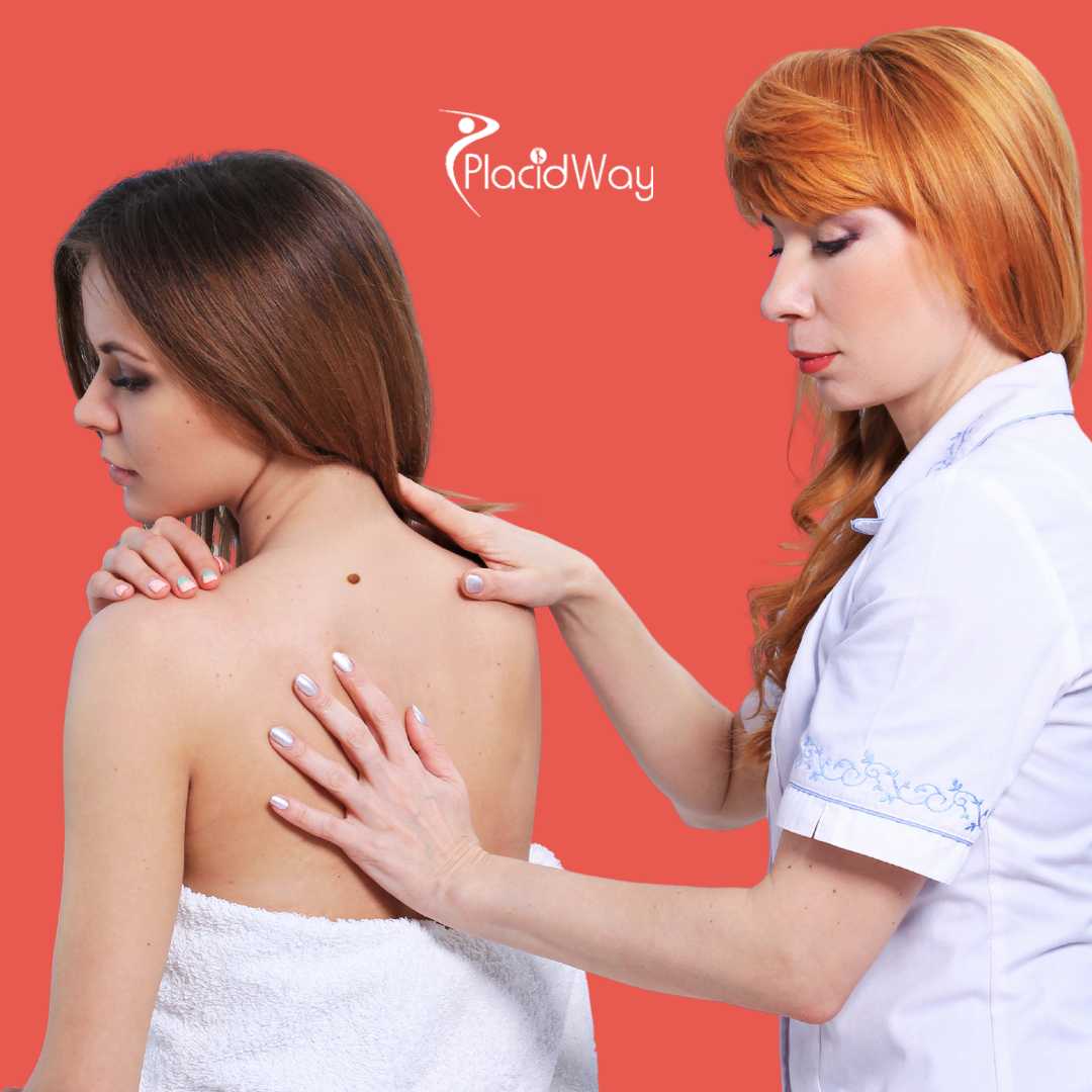 Melanoma Treatment in Mexico: Exploring the Role of Immune and Alternative Therapies for Better Outcomes 