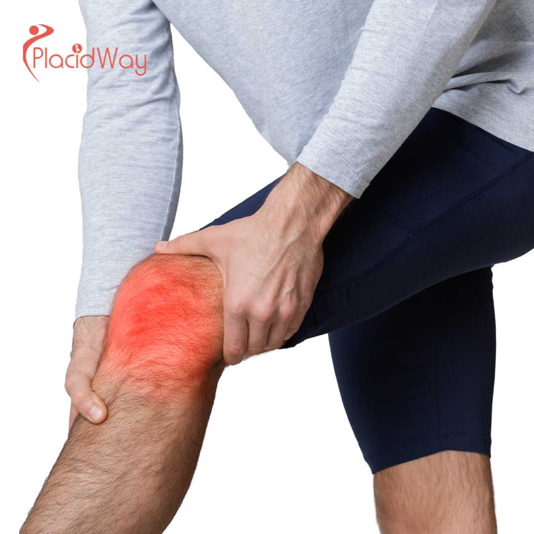 5 Benefits of Meniscus Repair in Istanbul, Turkey