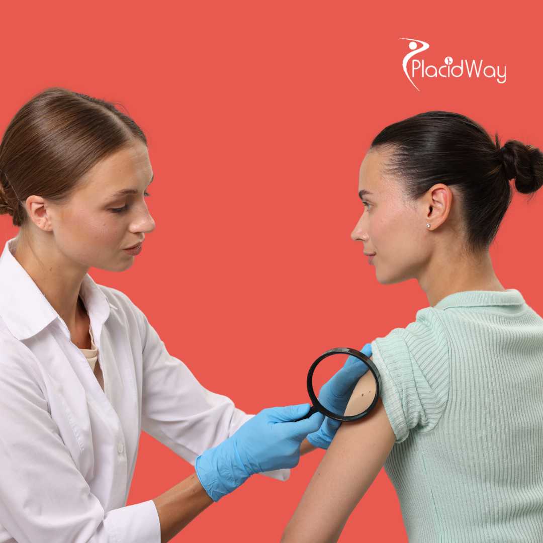 Melanoma Treatment in Mexico: Combining Immune and Alternative Therapies for Better Outcomes