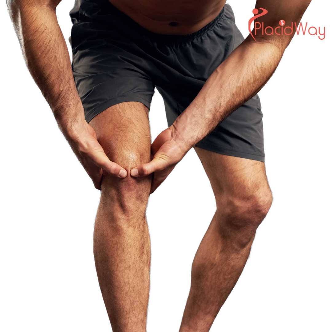 6 Things to Know About ACL, Meniscus & Sports Surgery in Tijuana