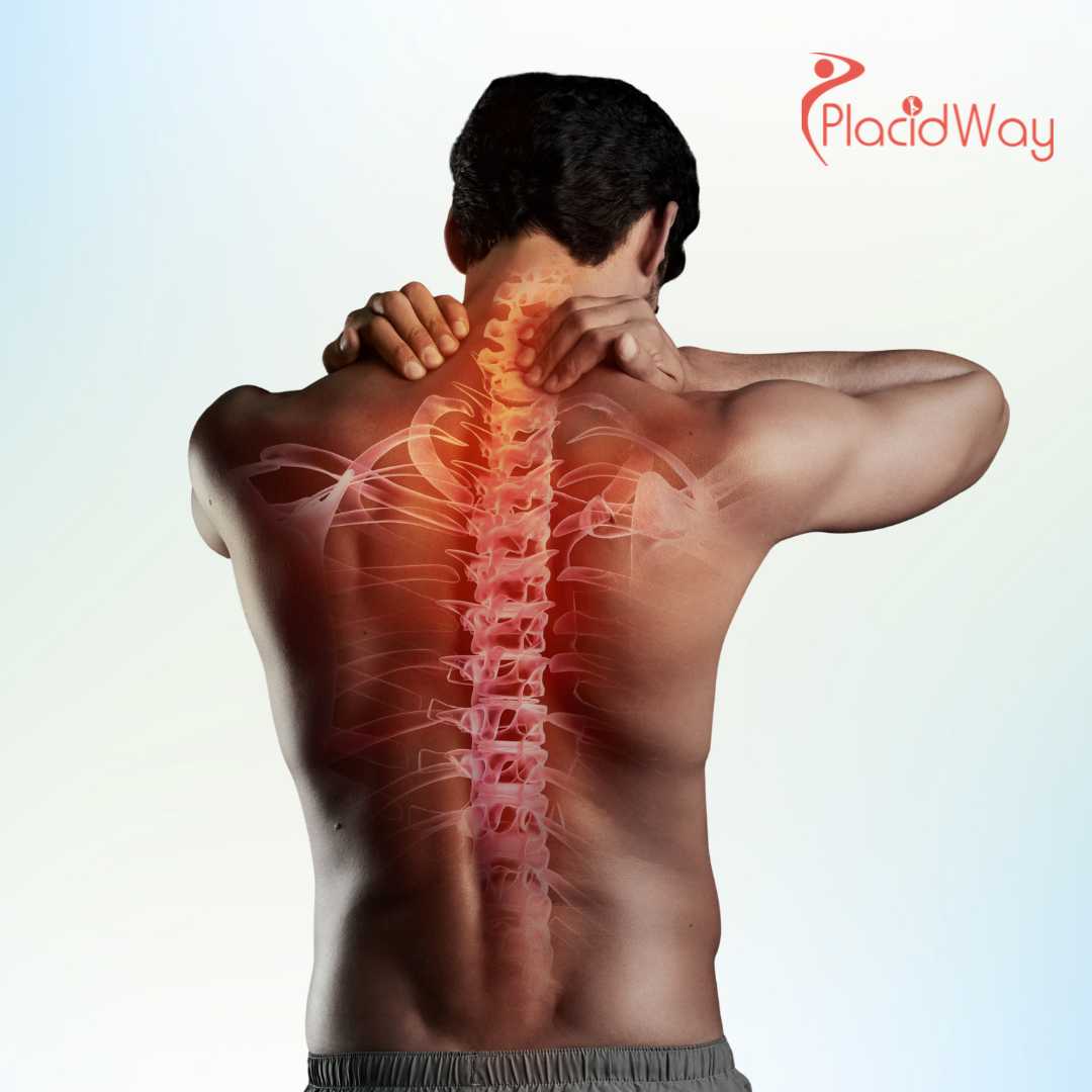 Stem Cells for Spinal Cord Injury in Cancun: Restoring Mobility and Function