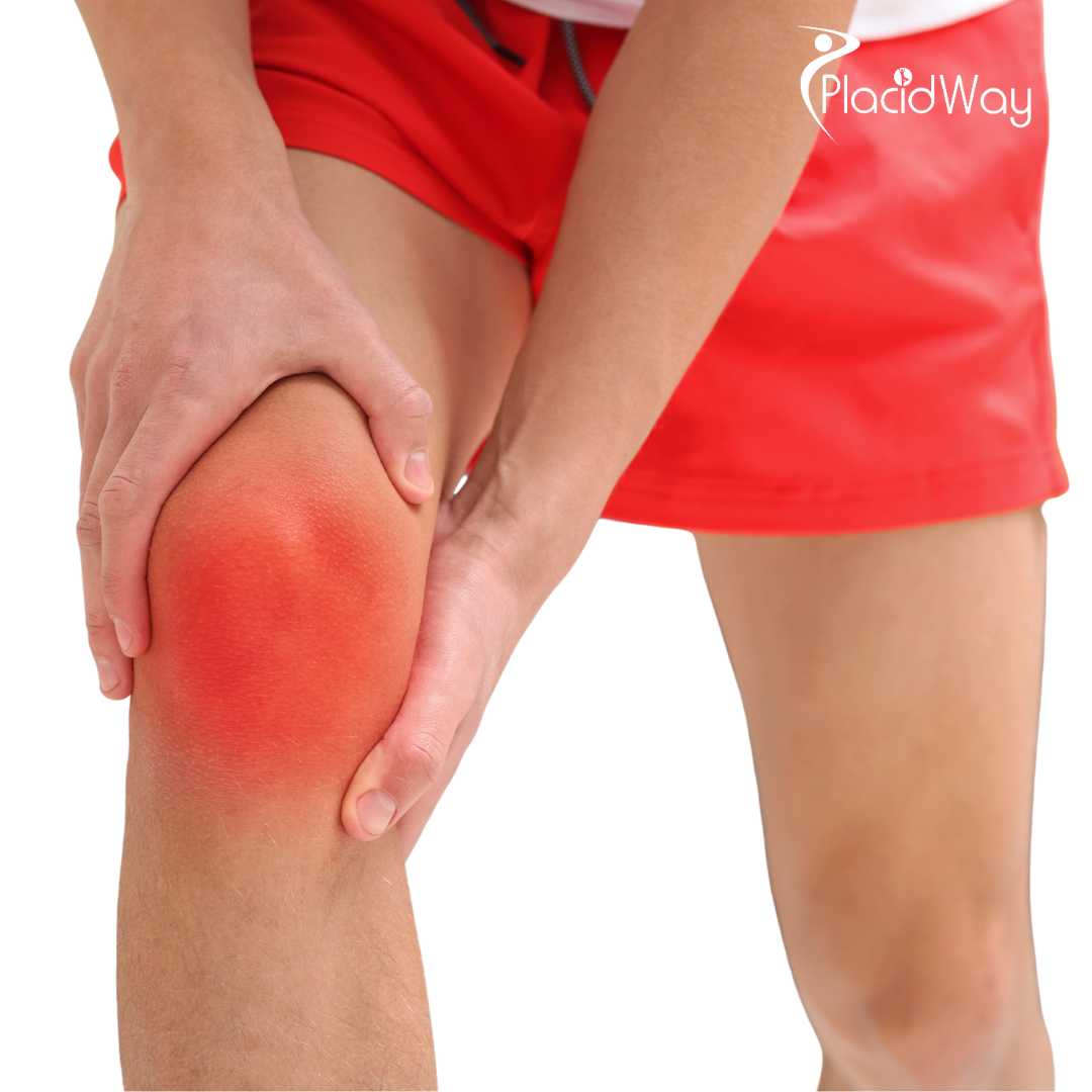 Stem Cell Therapy for Knee Osteoarthritis in Japan: A Regenerative Option for Pain and Mobility