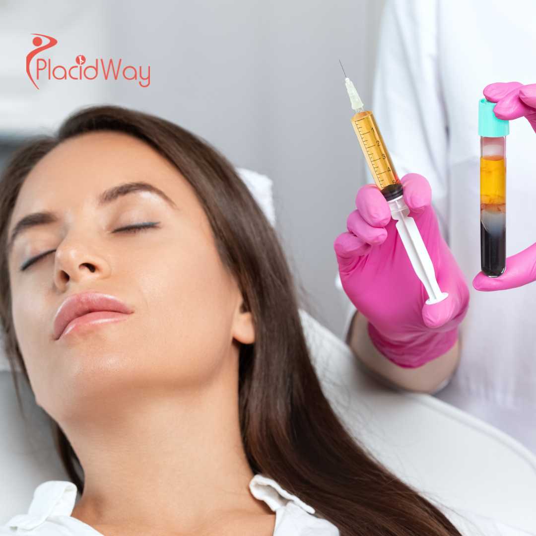 PRP Treatment Cost in Japan: Pricing, Factors That Affect Cost, and What’s Included