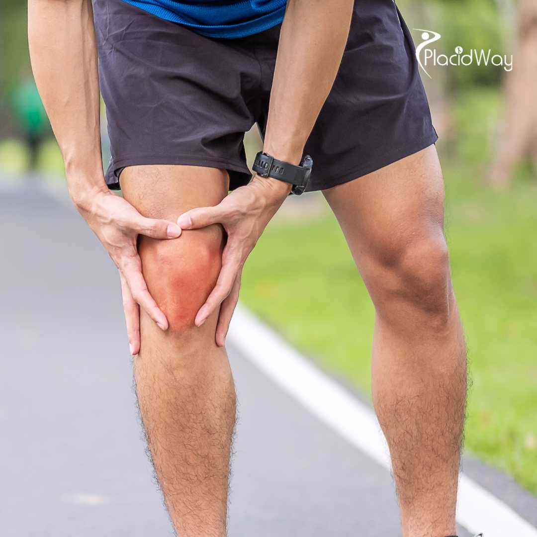 Guadalajara Surpasses US Centers in Regenerative Orthopedics and Knee Cell Science