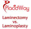 Laminectomy VS Laminoplasty Which One Is Best For Me?