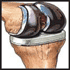 Dr Narendra Vaidya Uses Latest Technology in the Orthopedics and Joint Replacement Field