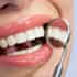 Porcelain Veneers in Costa Rica - Best Prices