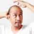 All You Need to Know About Hair Transplant in Thailand