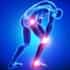 MexStemCells Clinic Stem Cell Therapy for Orthopedic Diseases