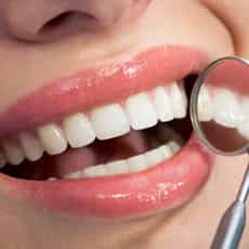 Dental Implants in Los Algodones, Mexico - Top Mexican Dentists