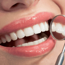 Dental Implants in Los Algodones, Mexico