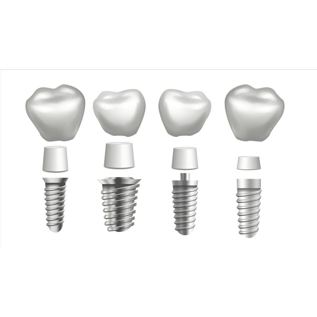 All on 4 in Costa Rica - Low-Cost Dental Implants