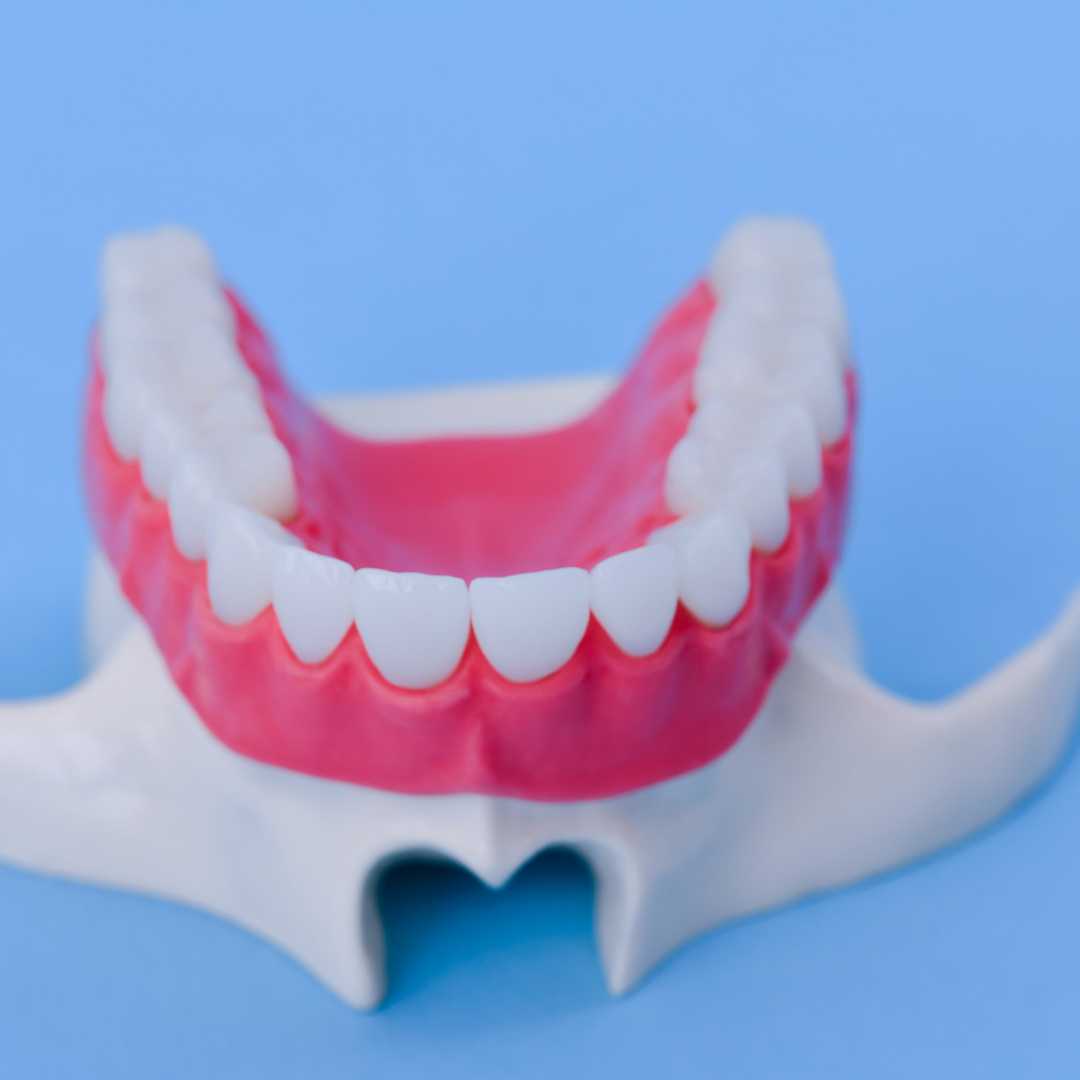 Dental Crowns in India - Quality Dental Work