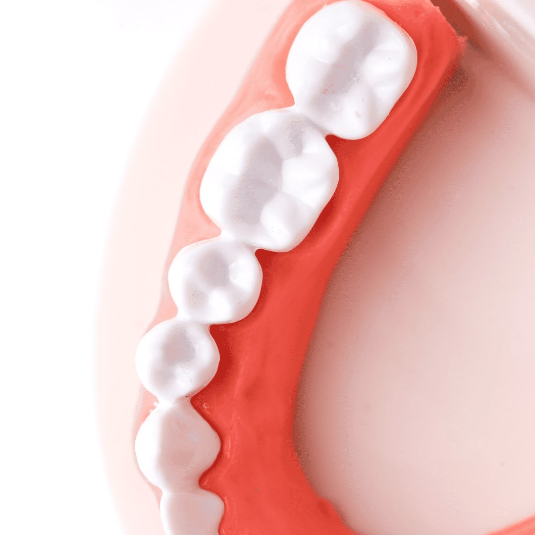 Dental Crowns in Costa Rica: Affordable Dental Care 