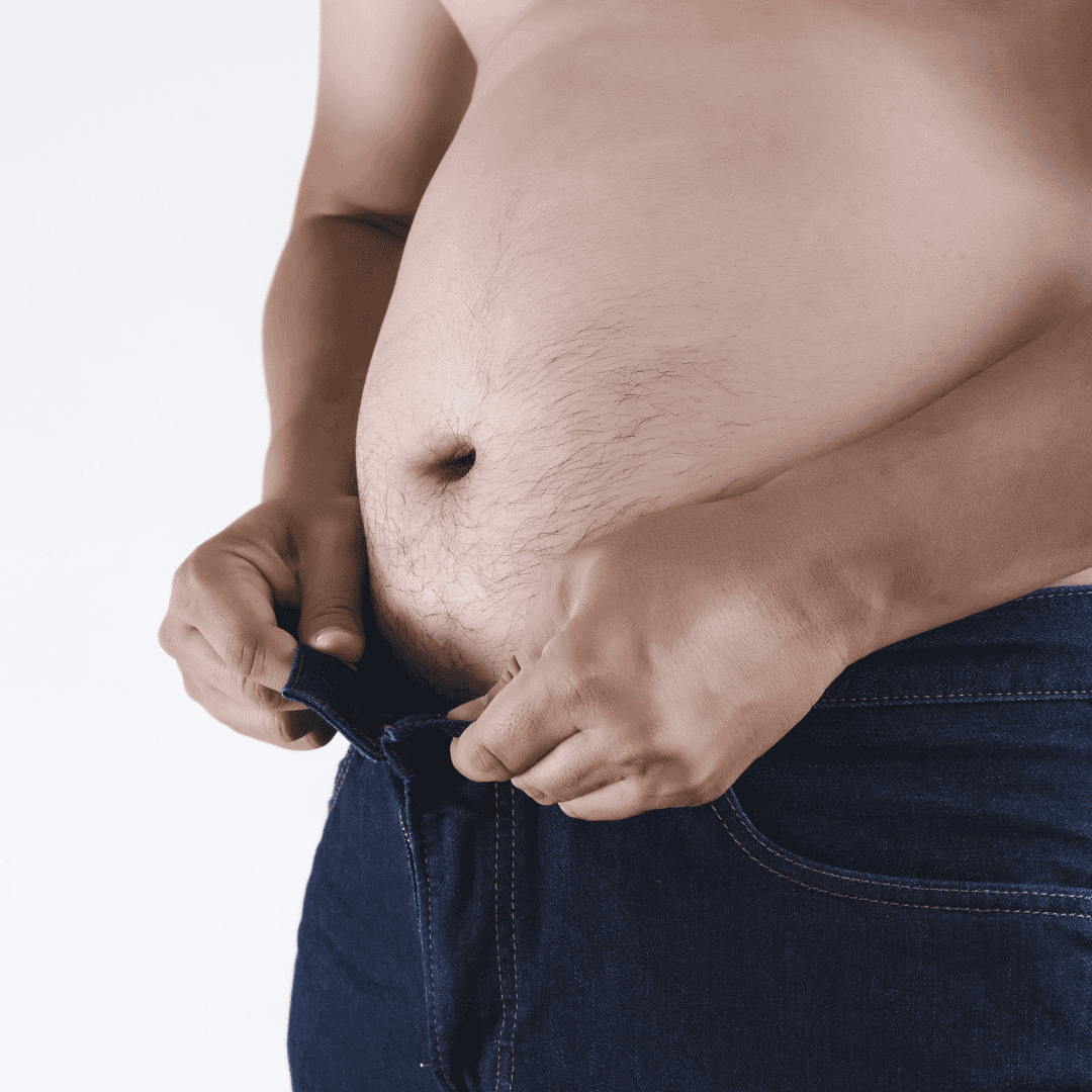 Lose Weight with Gastric Bypass in India