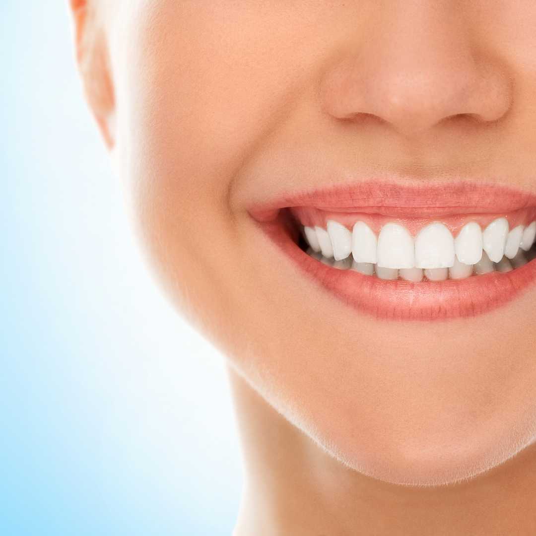 Get Your All on 6 Dental Implants in Thailand