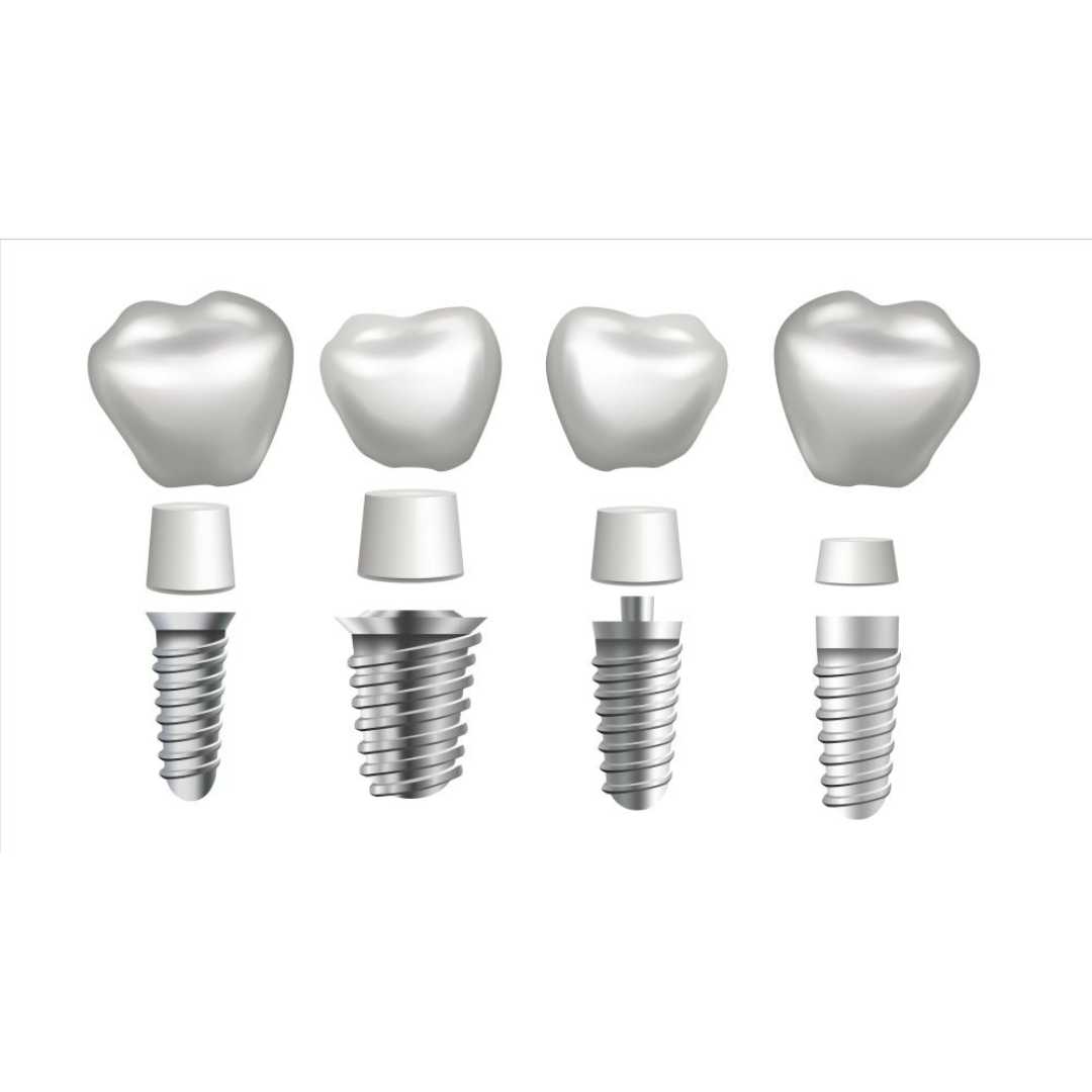 All on 4 Dental Implants in India